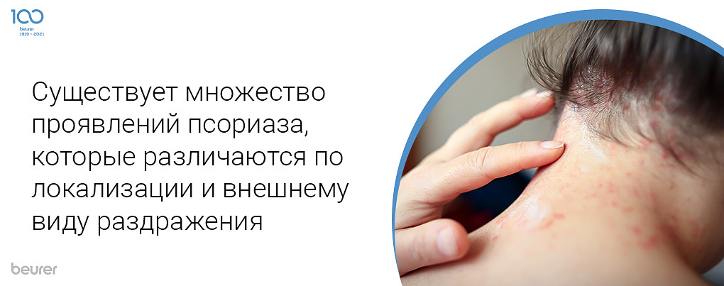Существует множество проявлений псориаза, которые различаются по локализации и внешнему виду раздражения