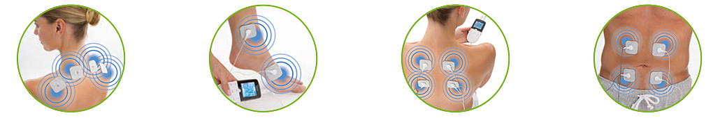 миостимуляторы