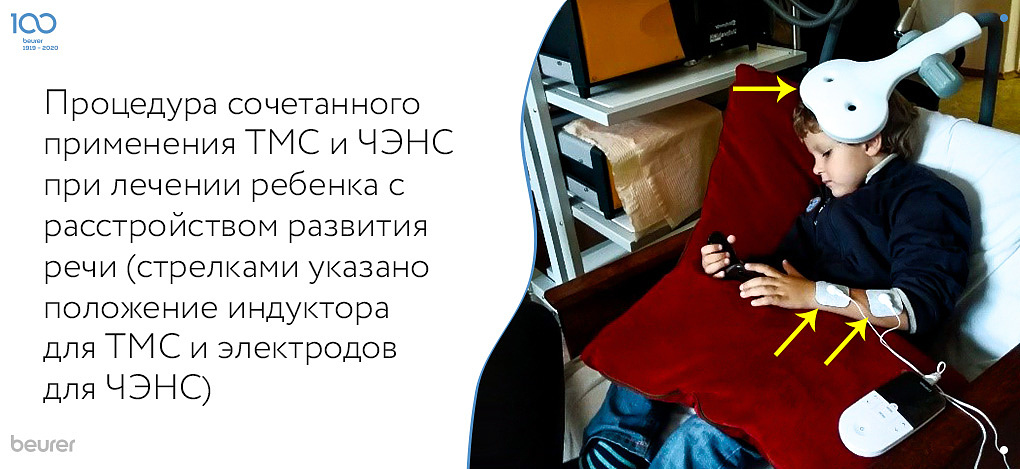 Процедура сочетанного применения ТМС и ЧЭНС при лечении ребенка с расстройством развития речи.jpg