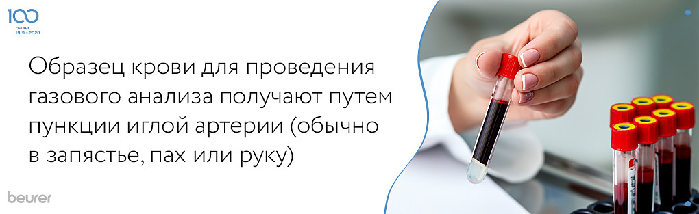 образец крови для проведения газового анализа получают путем пункции иглой артерии.jpg образец крови для проведения газового анализа получают путем пункции иглой артерии.jpg