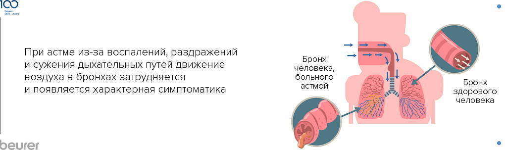 Астма: почему возникает и как проявляется