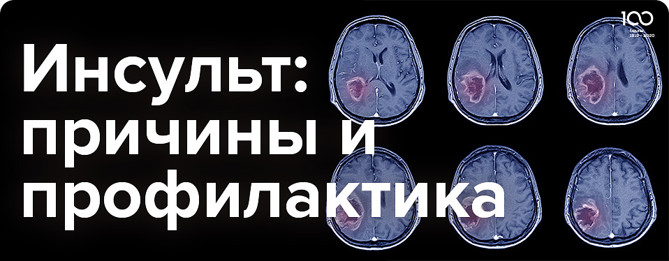 Инсульт: причины и профилактика