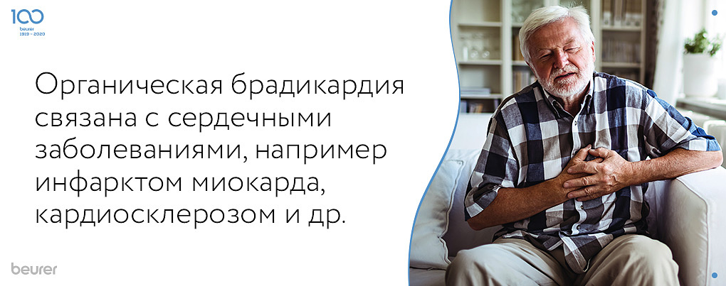 Органическая брадикардия связана с сердечными заболеваниями, например инфарктом миокарда, кардиоскрозом и др..jpg