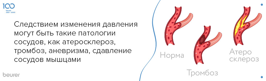следствием изменения давления могут быть такие патологии сосудов как атеросклероз тромбоз аневризма.jpg