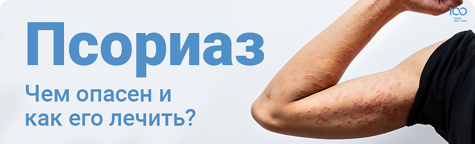 Псориаз: чем опасен и как его лечить? Псориаз: чем опасен и как его лечить?